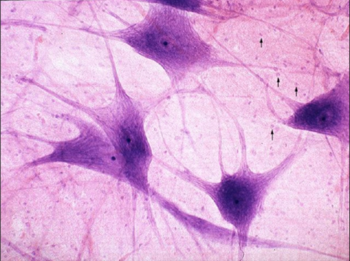 <p>what kind of tissue is this</p>