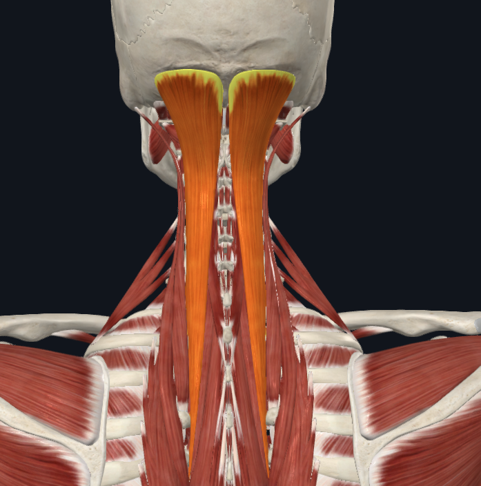 <p><strong>Nombre alterno: </strong>Digástrico de la nuca, Semiespinoso de la cabeza</p><p><strong><mark data-color="yellow" style="background-color: yellow; color: inherit">Origen: </mark></strong><mark data-color="yellow" style="background-color: yellow; color: inherit">C3-T6</mark></p><p><strong><mark data-color="blue" style="background-color: blue; color: inherit">Inserción: </mark></strong><mark data-color="blue" style="background-color: blue; color: inherit">Línea nucal inferior</mark></p><p><strong><mark data-color="red" style="background-color: red; color: inherit">Acción: </mark></strong><mark data-color="red" style="background-color: red; color: inherit">Extensor puro de la cabeza. Leve lateralizador</mark></p><p><strong><mark data-color="purple" style="background-color: purple; color: inherit">Inervación: </mark></strong><mark data-color="purple" style="background-color: purple; color: inherit">Plexo cervical</mark><strong><br><mark data-color="green" style="background-color: green; color: inherit">Relaciones: </mark></strong><mark data-color="green" style="background-color: green; color: inherit">Fondo de triángulo de los esplénicos</mark></p><p><strong>Notas:</strong></p><p></p>
