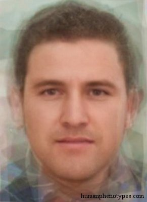 <p>Identify this Phenotype</p>