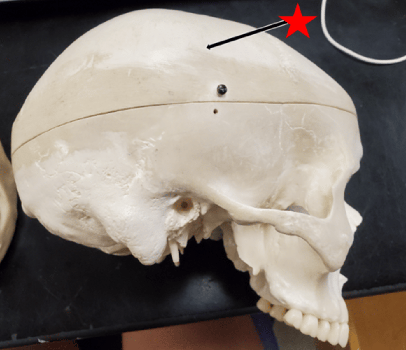 <p>Name the starred region in the image.</p>
