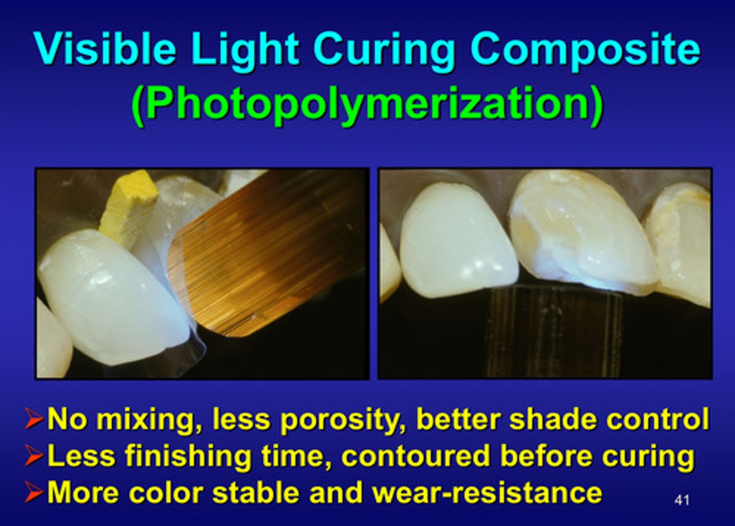 <p>1) no mixing, less porosity, better shade control</p><p>2) less finishing time, contoured before curing</p><p>3) more color stable and wear-resistant</p>