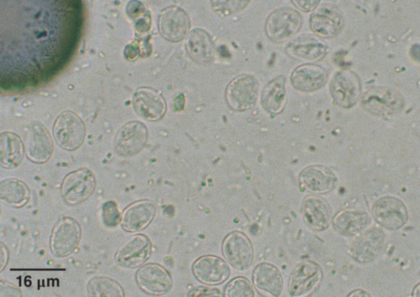 <p>What parasite is this if it is from a dog</p>