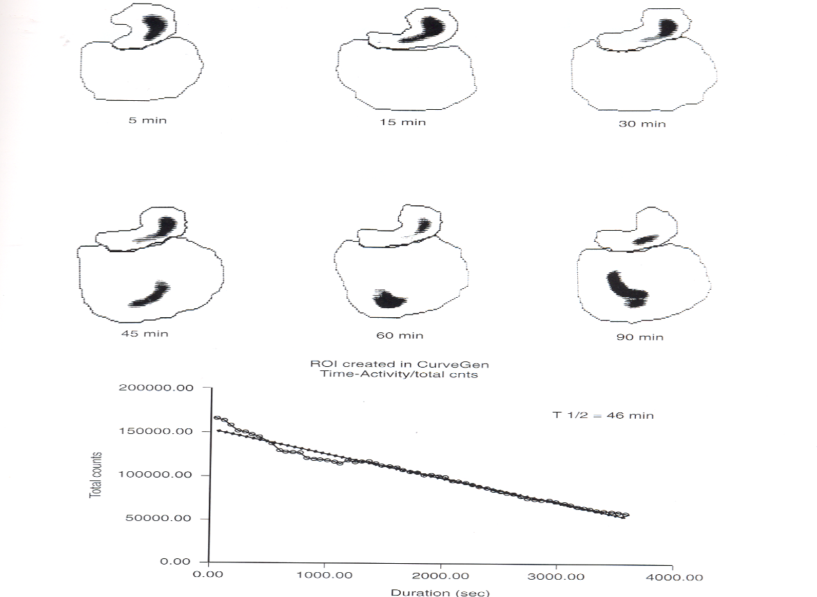 <p>what is this pictuer showing?</p>