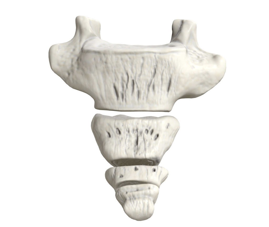 <p>Identify the bone.</p>