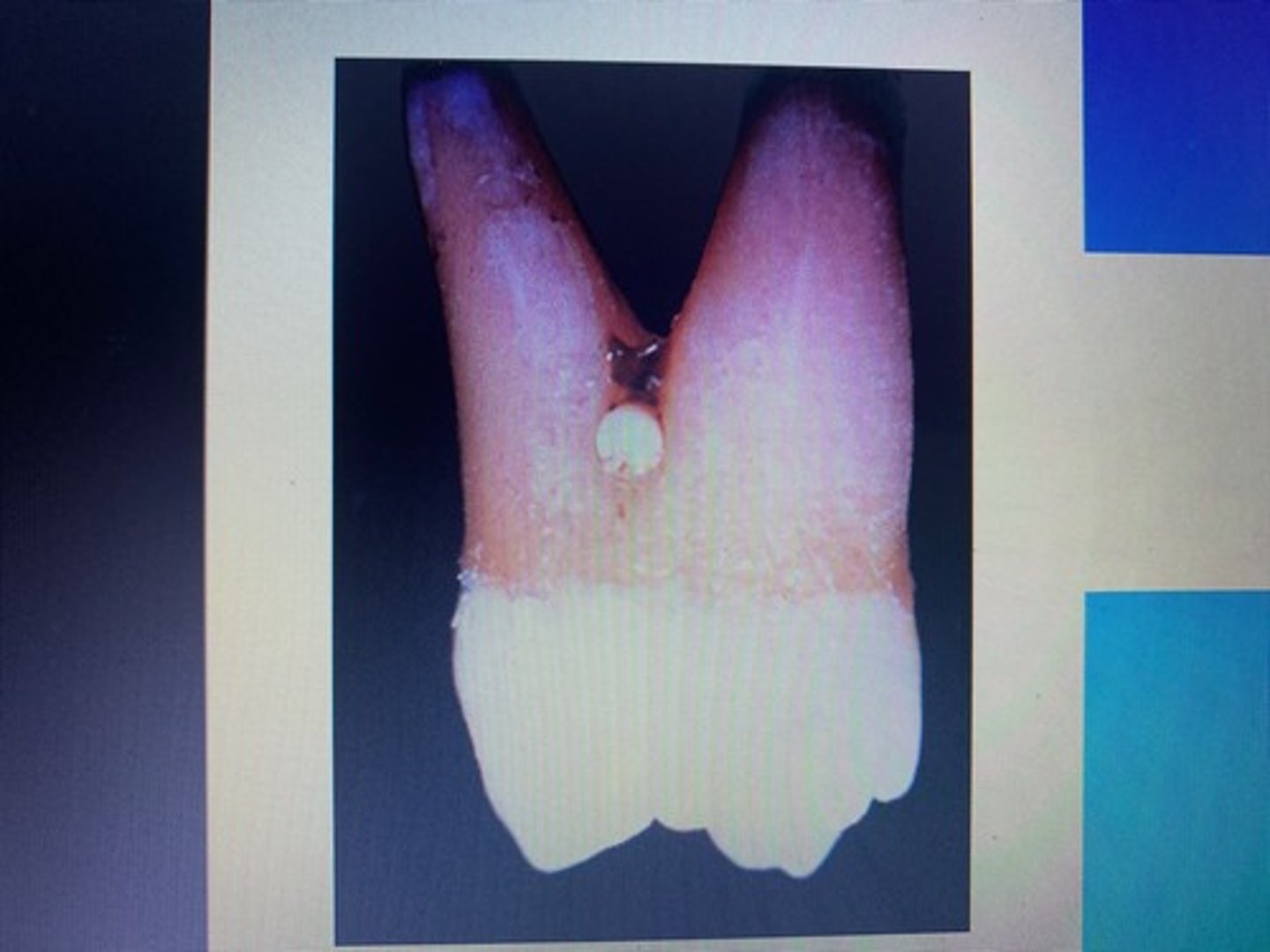<p>Enamel pearl</p>