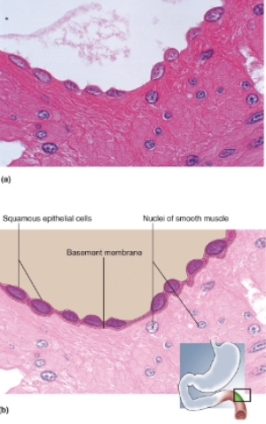 <p>Single layer of thin cells, shaped like fried eggs with bulge where nucleus is located; nucleus flattened in the plane of the cell</p>