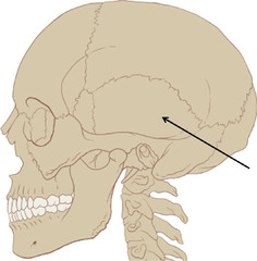Name this bone.