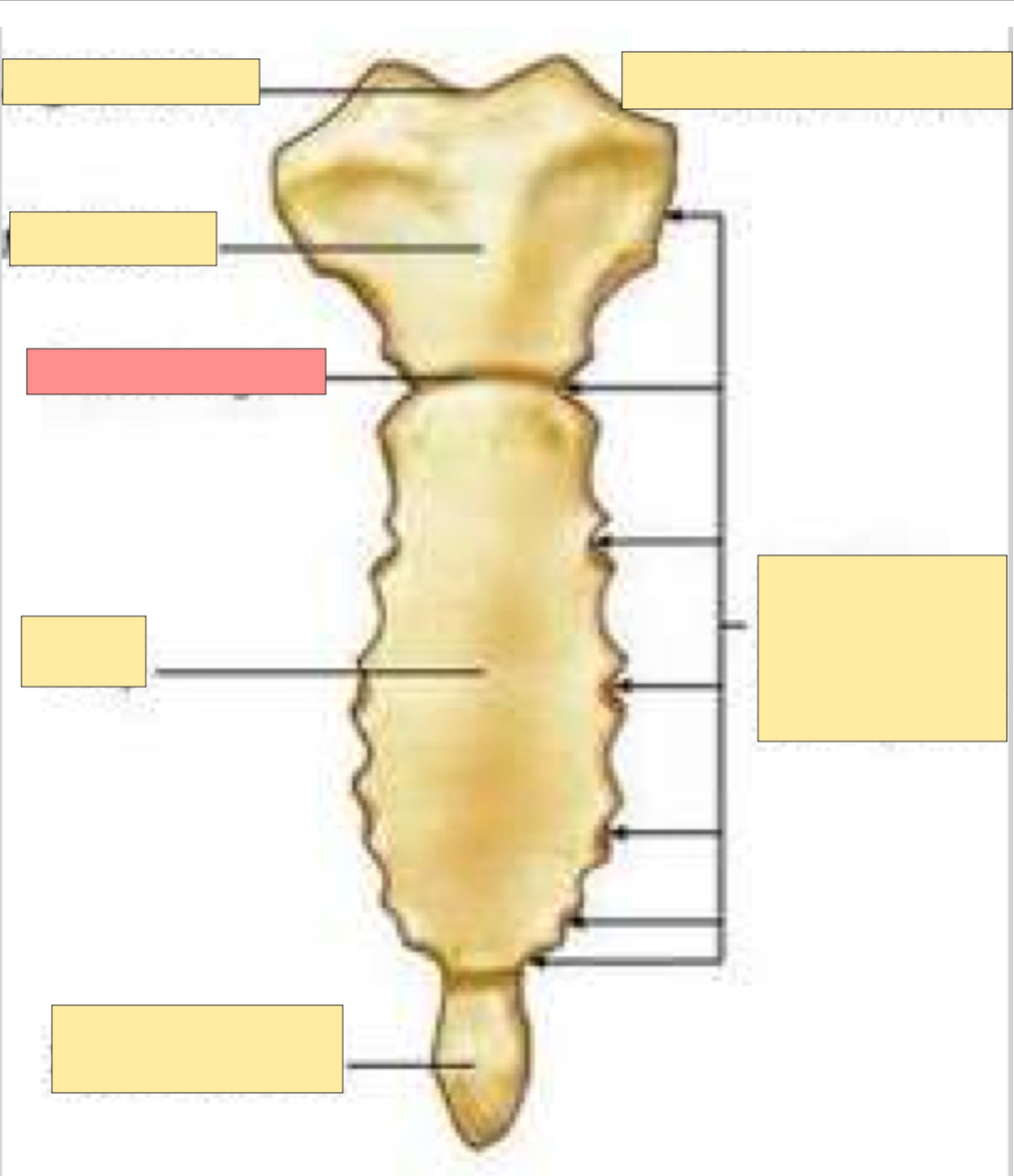 <p>What part of the sternum is this?</p>