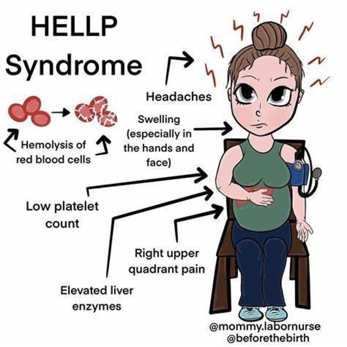 <p>A syndrome characterized by Hemolysis, Elevated Liver enzymes, and Low Platelets in pregnant and postpartum patients.</p>