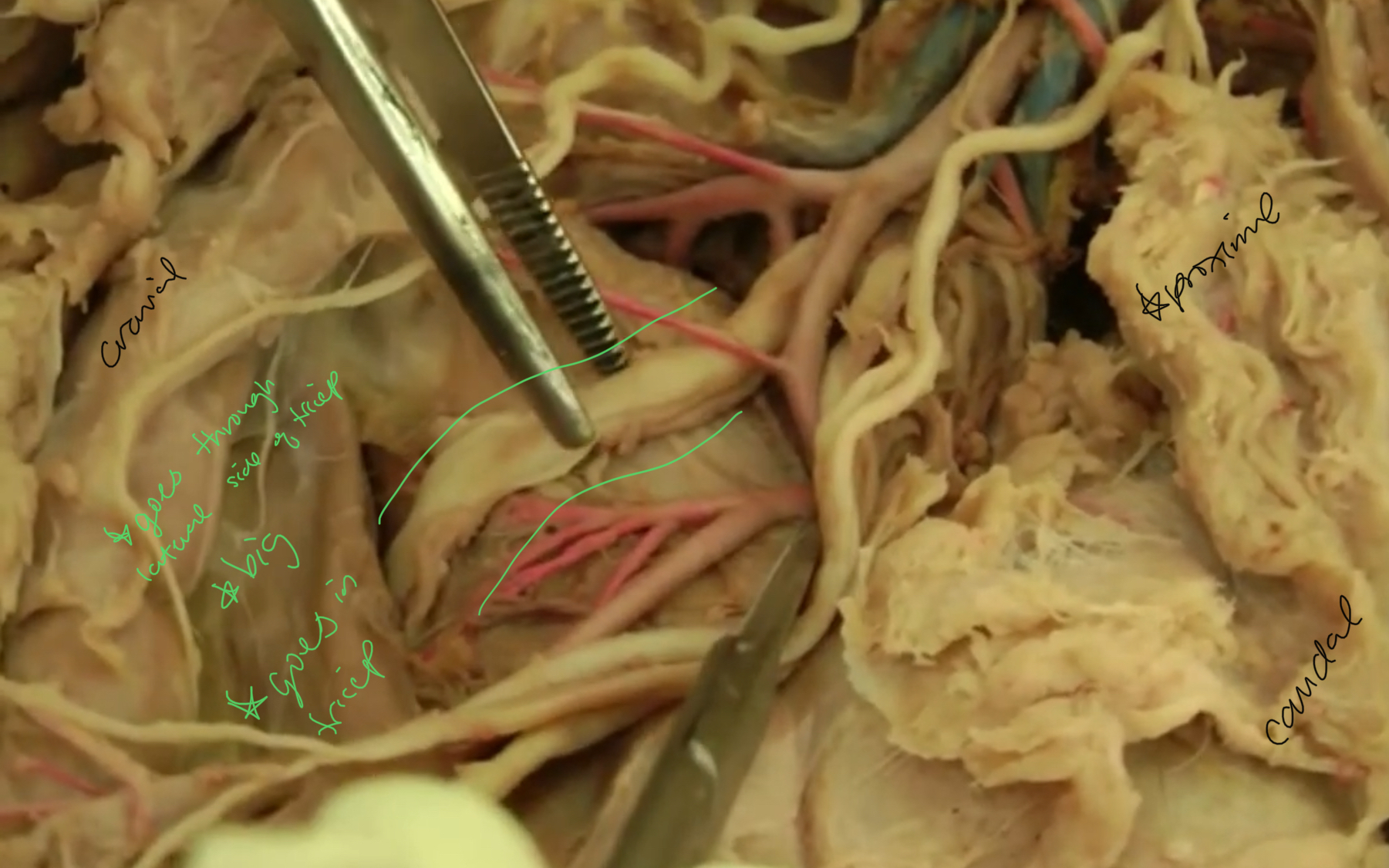 <p>what nerve is highlighted?</p>