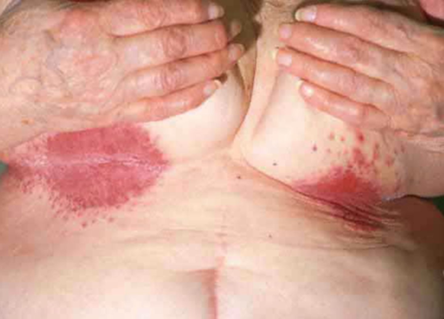 <p>change associated with type 2 diabetes</p>