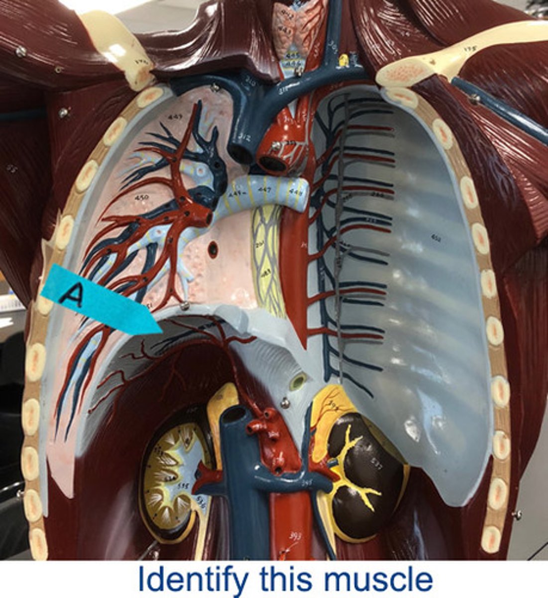 <p>Identify this muscle</p>