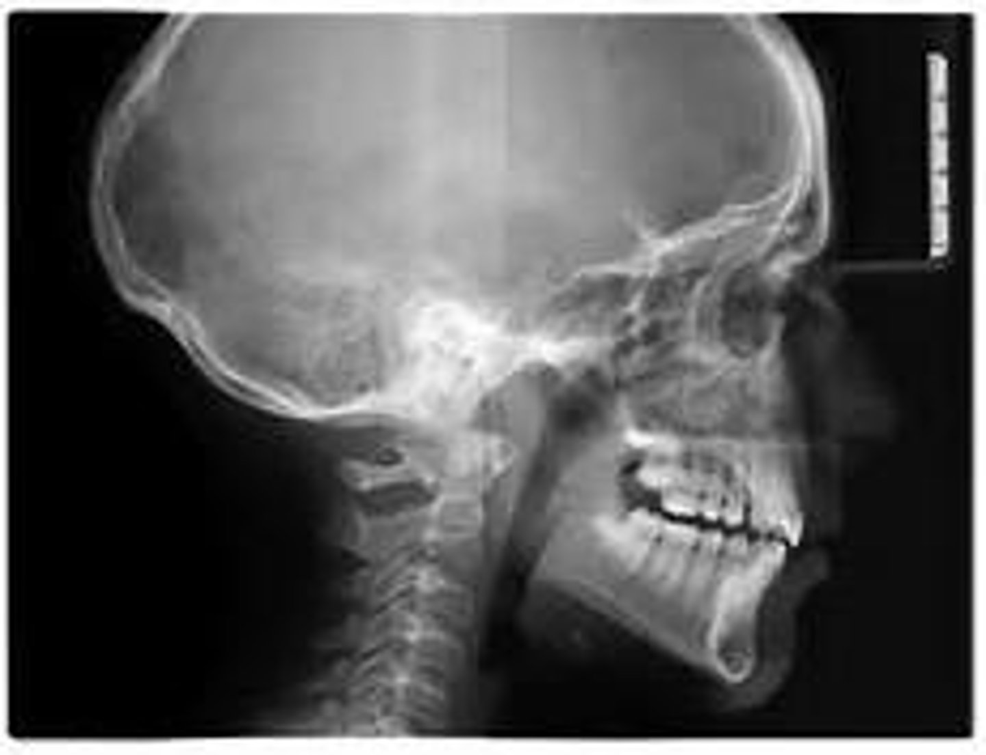 <p>what type of x-ray is this?</p>