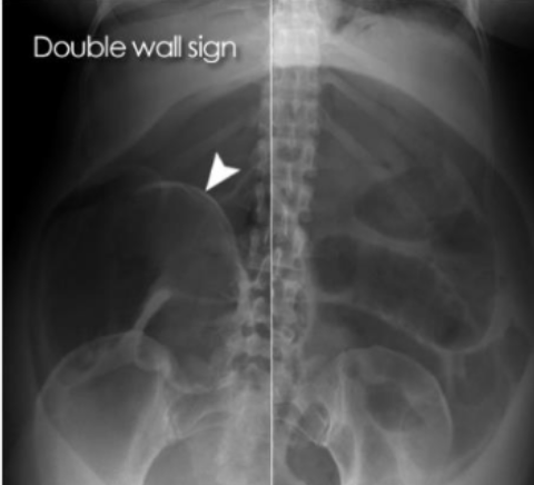 <p>What is this and what type of scan </p>