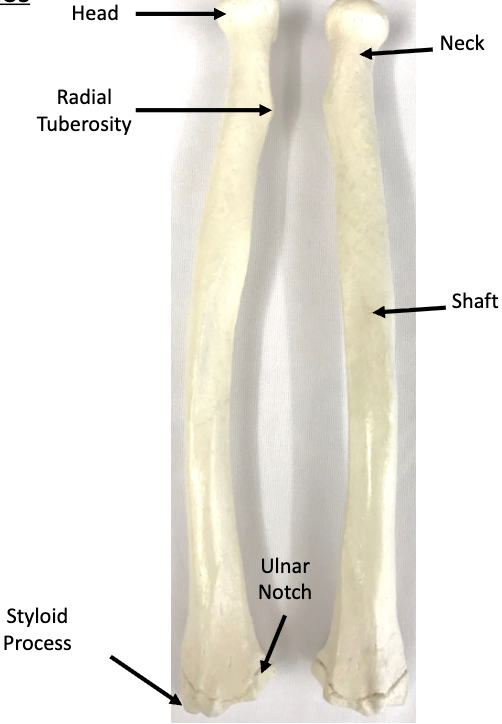 <p>What bone is this?</p>