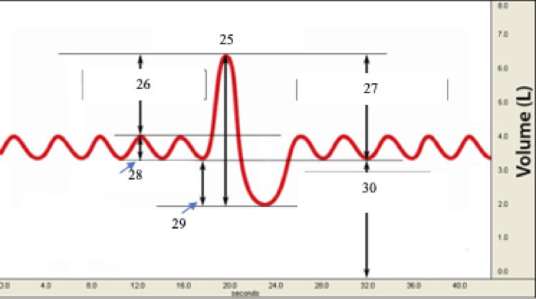 <p>(T1) Label #30 on the graph below (the vertical line by the 30 should be continuous)</p><ul><li><p>tidal volume</p></li><li><p>functional residual (reserve) capacity</p></li><li><p>expiratory reserve volume</p></li><li><p>inspiratory reserve volume</p></li><li><p>residual volume</p></li></ul>