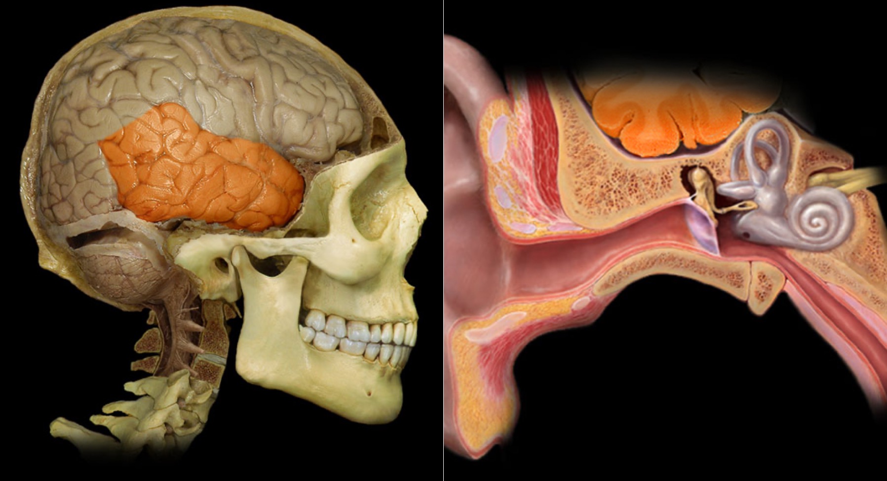 <h4 collapsed="false" seolevelmigrated="true"><strong>Location:</strong></h4><ul><li><p>Lateral and inferior portion of each cerebral hemisphere</p></li><li><p>Inferior to lateral sulcus</p></li></ul><h4 collapsed="false" seolevelmigrated="true"><strong>Description:</strong></h4><ul><li><p>Lateral surface has three parallel gyri</p></li></ul><h4 collapsed="false" seolevelmigrated="true"><strong>Function:</strong></h4><ul><li><p>Primary hearing and smell areas</p></li><li><p>Memory</p></li><li><p>Speech perception and recognition (i.e., Wernicke's area - usually in left hemisphere)</p></li></ul><h4 collapsed="false" seolevelmigrated="true"><strong>Comment:</strong></h4><ul><li><p>Named for overlying bone</p></li></ul>