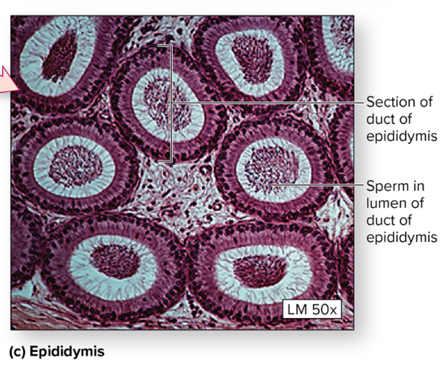 <p>Epididymis </p>