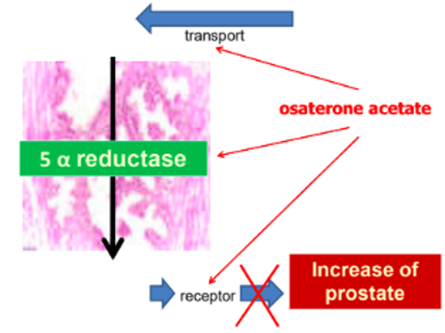 <p>a. Blocks the androgen receptor and inhibits the action of 5-alpha-reductase</p><p>(Lecture note:</p><p>Blocks the androgen receptors and testosterone metabolism to DHT which results in low level of intracellular androgen</p><p>Prevent binding of androgens with its receptors in the prostate and blocks the testosterone transport to the prostate)</p>