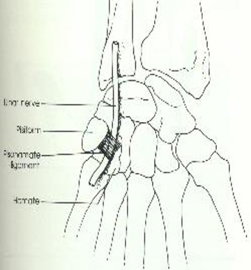 \-Contents: Ulnar nerve

\-Borders: Hook of hamate & Pisiform bone

\-Lies superficial to transverse carpal ligament