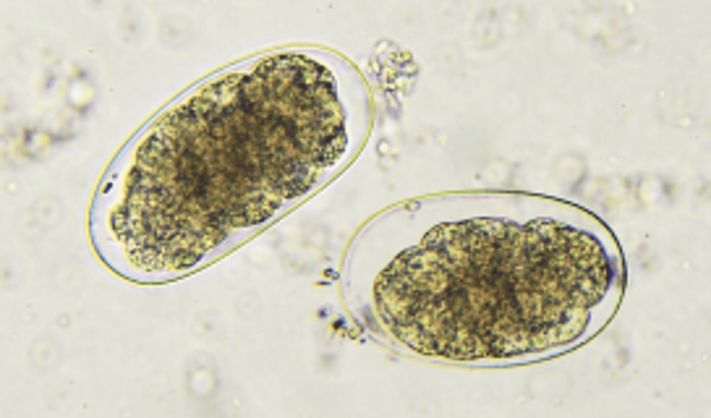 <p>Female: 9-13mm</p><p>Male: 5-11mm</p><p>Head slightly bent</p><p>A. dudenale slightly longer than N. americanus</p>