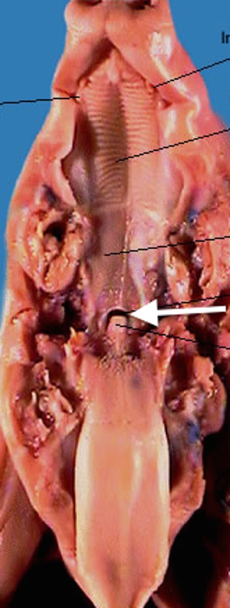 <p>Air passageway; contains pharyngeal tonsil</p>