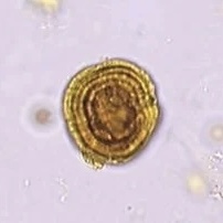 <ol><li><p>Identify structure.</p></li><li><p>What is the striking feature of this crystal that differentiates it from a morphologically the same urinary artifact?</p></li></ol><p></p>