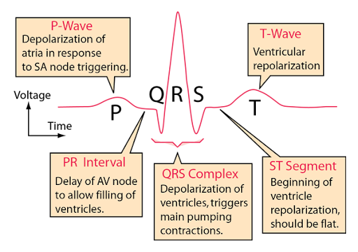 <p>Represents depolarisation in the septum</p><p>Whilst the electrical stimulus passes through the bundle of His, and before it separates down the two bundle branches, it starts to depolarise the septum from left to right.</p>