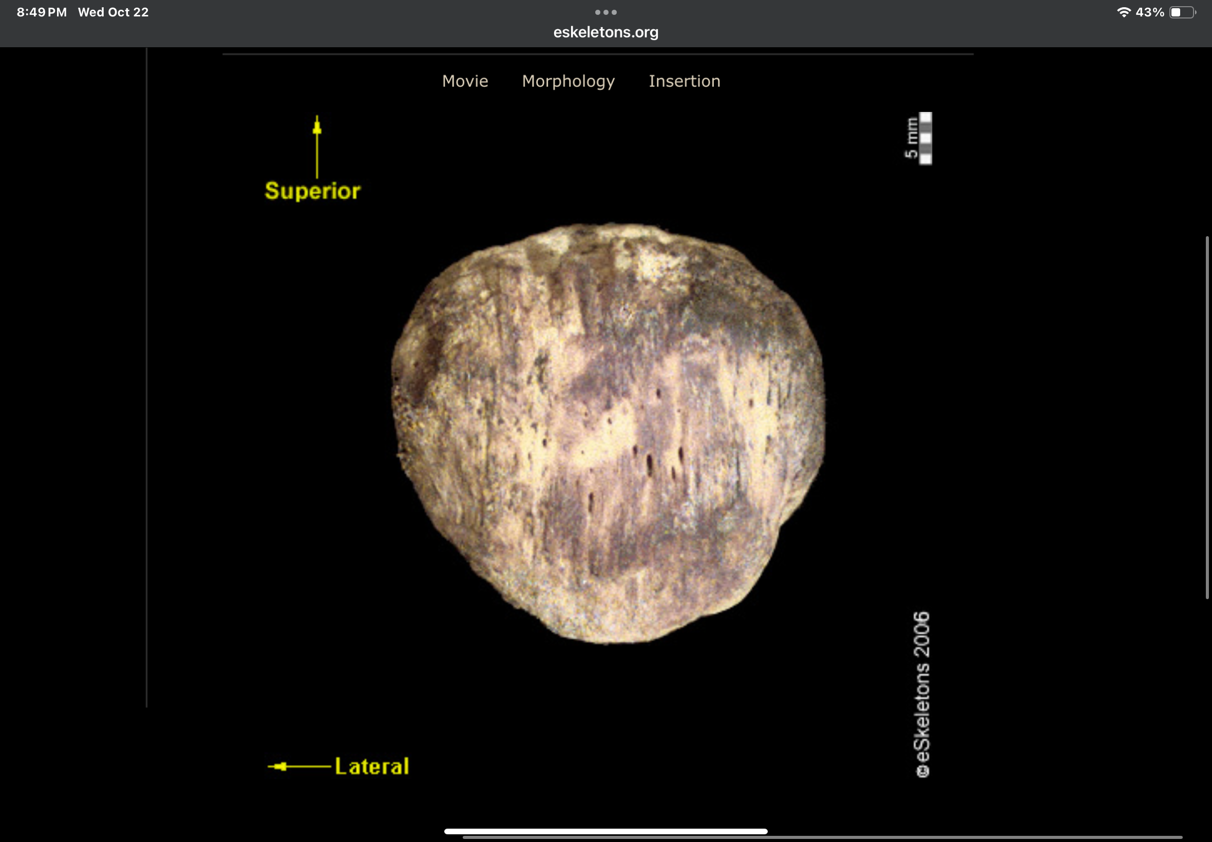 <p>Right or left?</p>