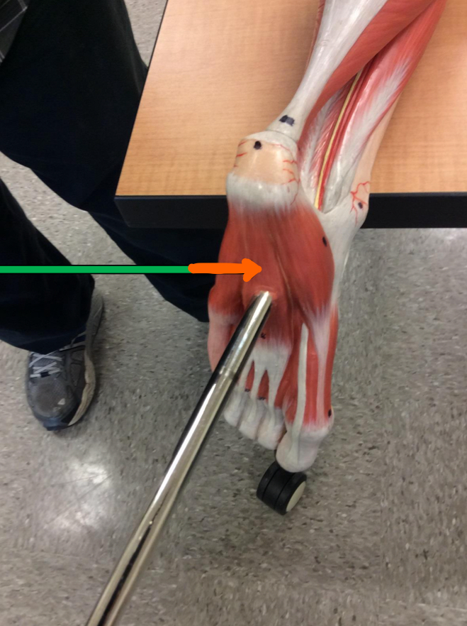 <p>Identify this muscle?</p>