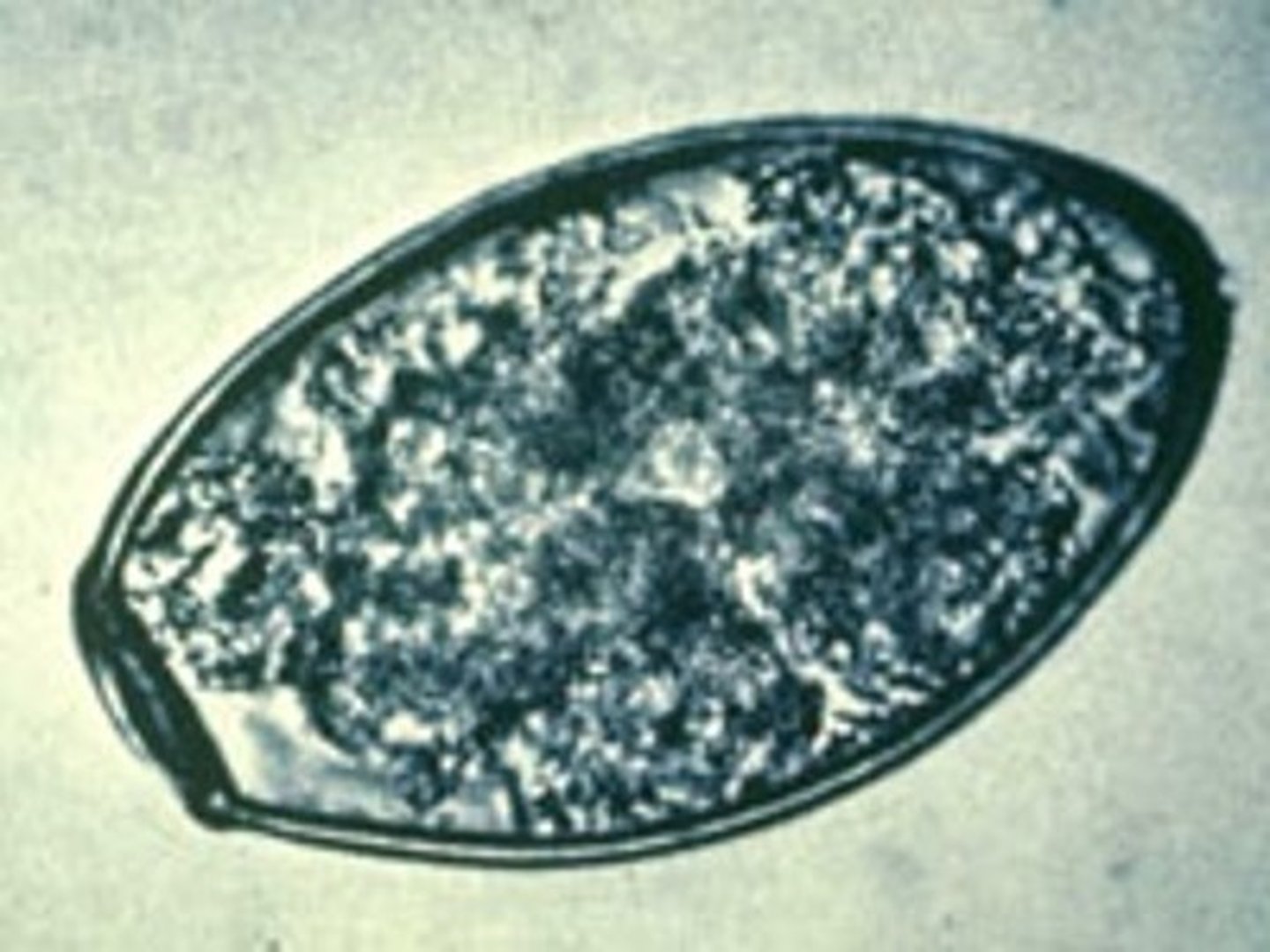 <p>This was found in the stool sample of a coughing cat. What is it?</p>