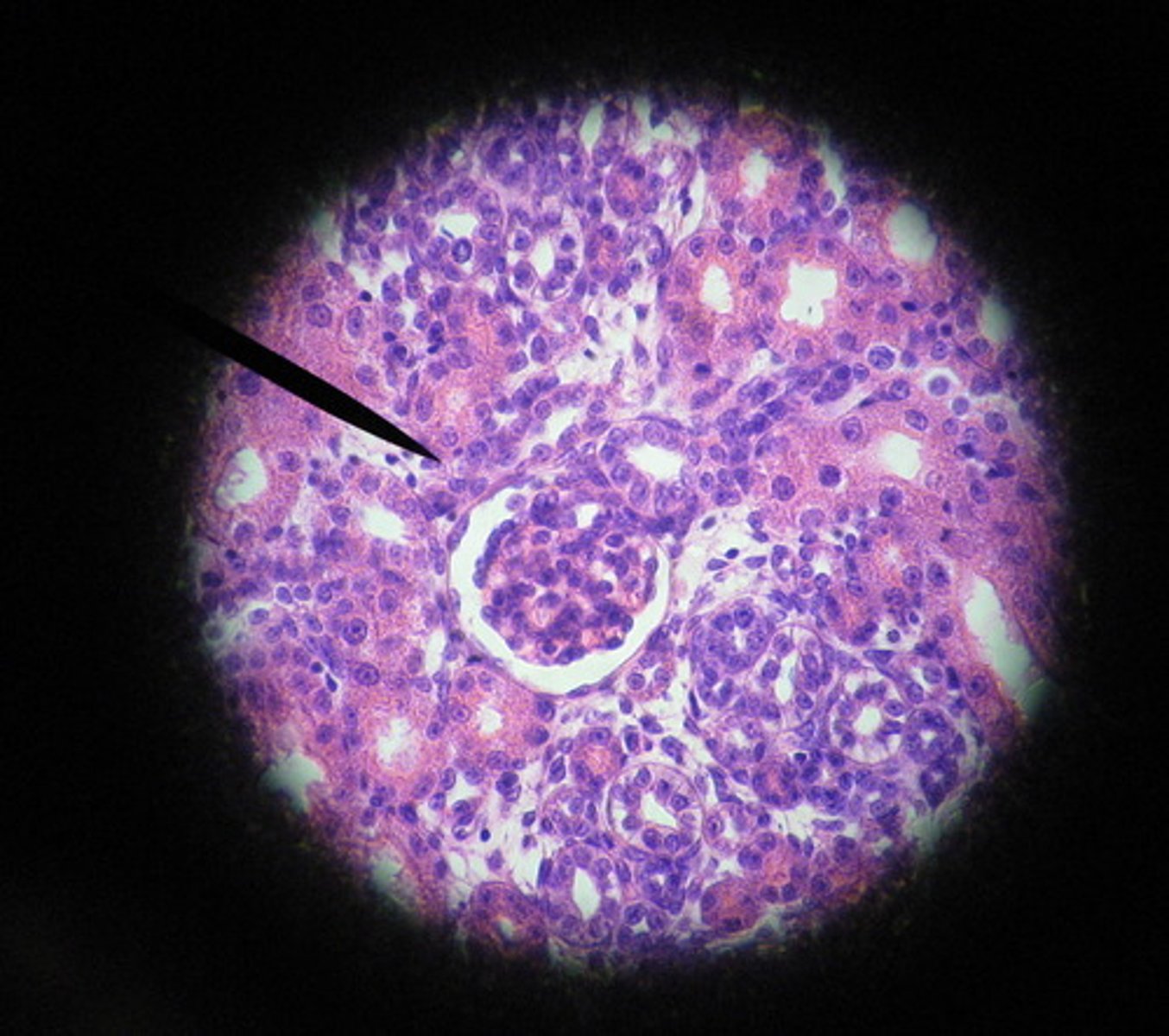 <p>(kidney)</p>