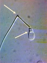 <p>Identify the sperm morphology.</p>