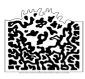 <p>A radiopacity that may exhibit an irregular, poorly defined pattern. May represent a malignant condition. </p>