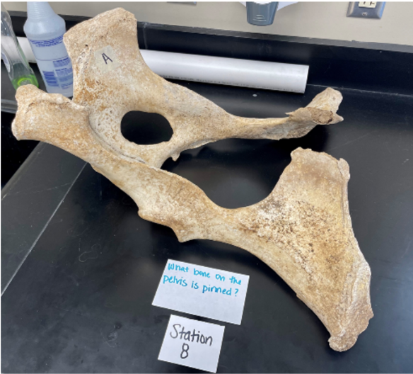 <p>What bone of the pelvis is pinned? </p>