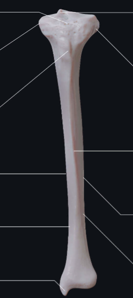 <p>What bone is this? (Appendicular)</p>
