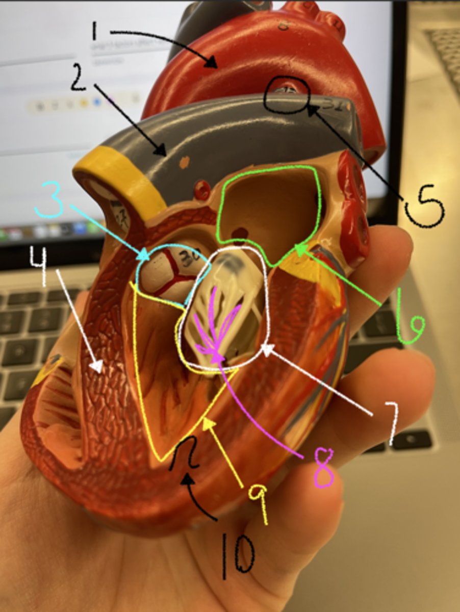 <p>what is structure 2</p>