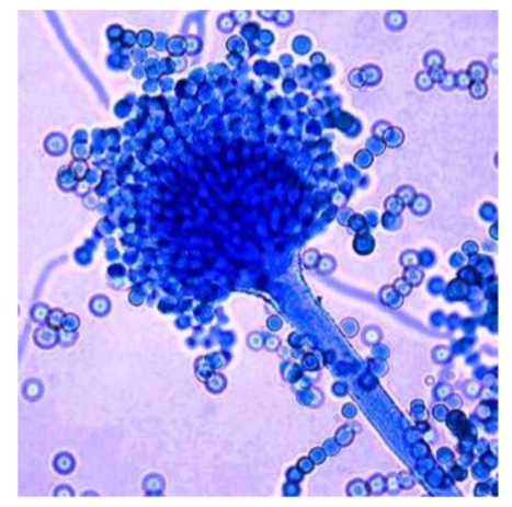 <p>What is the <strong>genus name</strong> of this organism + and its <strong>asexual spore</strong> structure?</p>