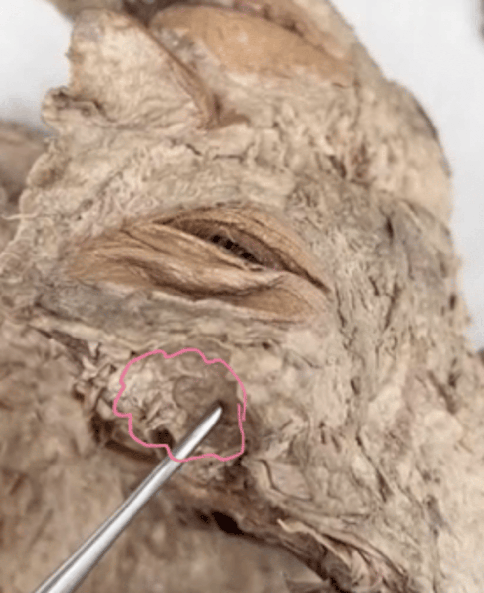 <p>Name the structure.</p>
