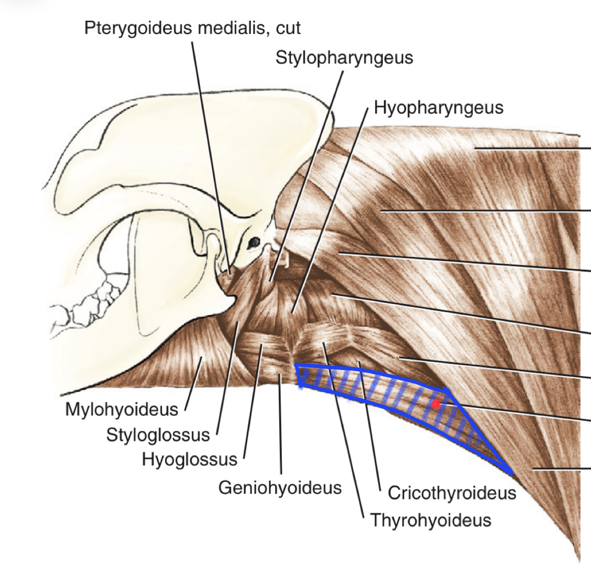 term image