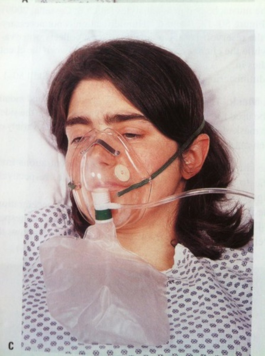 <p>-Flow rate: 6-10 L/minute </p><p>-Delivers the highest percentage of oxygen with intubation or mechanical ventilation</p><p>-Valves must be secure and functioning</p><p>-Cannot eat or drink with mask in place</p><p>-Reservoir bag must be kept inflated</p>