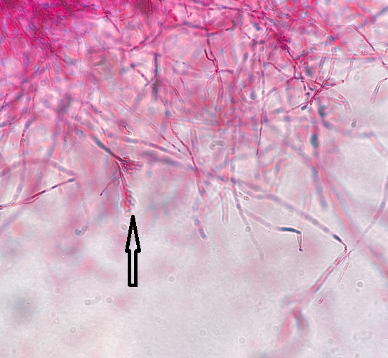 <p>What is the arrow pointing to?</p>