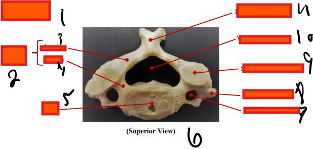 <p>superior</p>