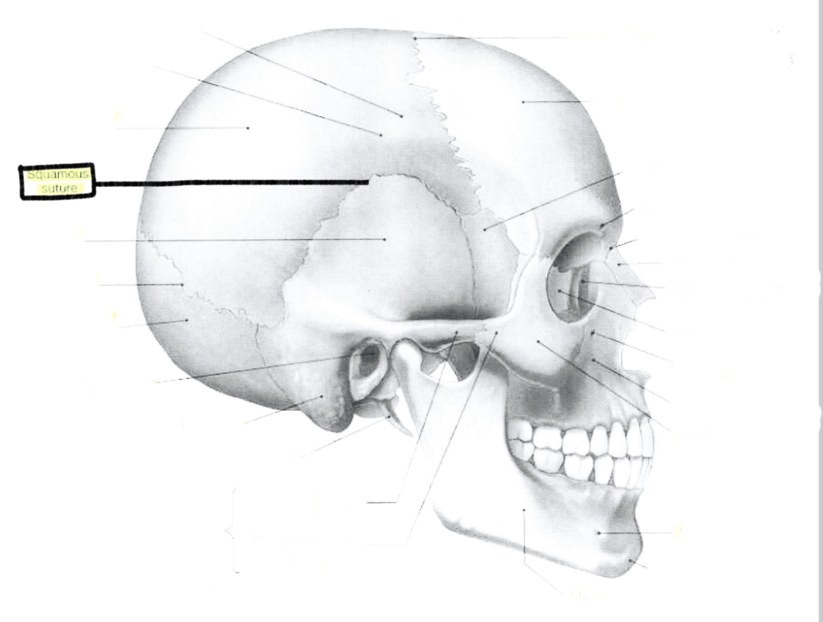 <p>Squamous suture</p>