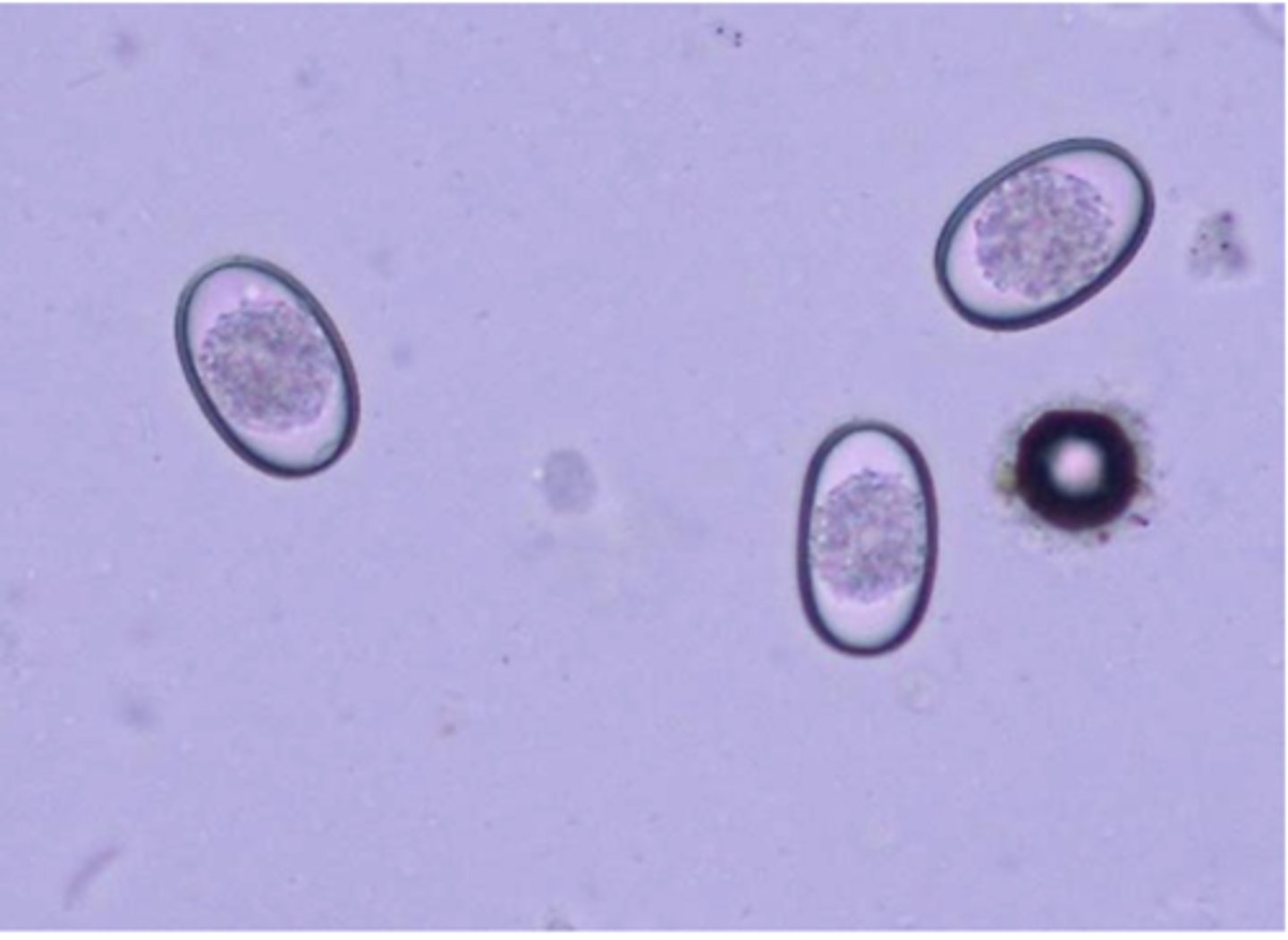 <p>SPURIOUS PARASITE OR PSEUDOPARASITE?</p><p><em>Eimeria </em>from an herbivore; found in dog feces</p>