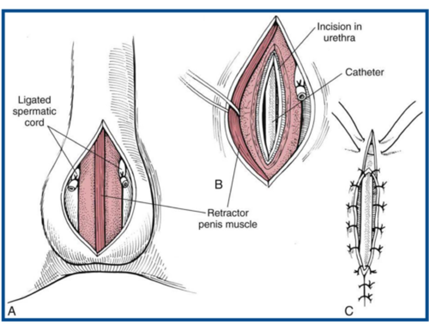 <p>characteristics of canine scrotal urethrostomy</p>