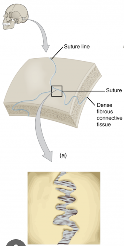 <p>The suture lines and skull.</p>