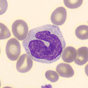 <p>Monocyte</p>