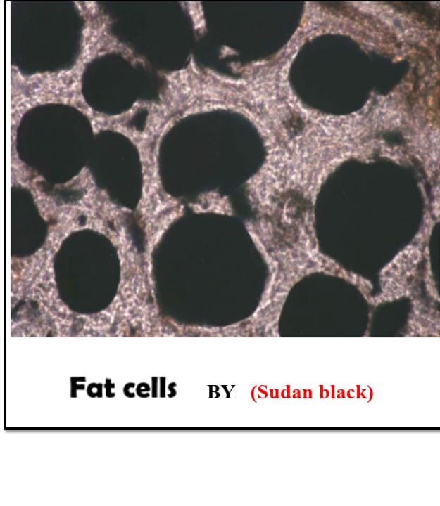<p>Term #14</p>