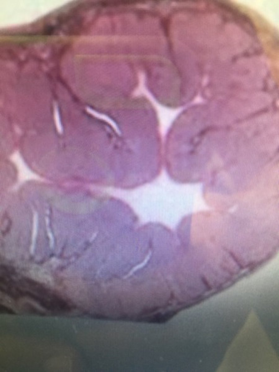 <p>After ovulation, the ruptured Graafian follicle differentiates to form this, which is a source of progesterone and estrogen..?</p>